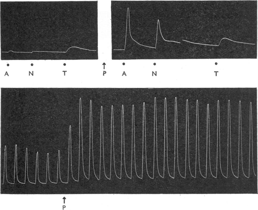 COCAINE AND ANTIDEPRESSANTS 347 0 0 0 *0 A N T P A N T t P Fig. 5. Spinal cats. Records of contractions of acutely decentralized nictitating membranes in two experiments.