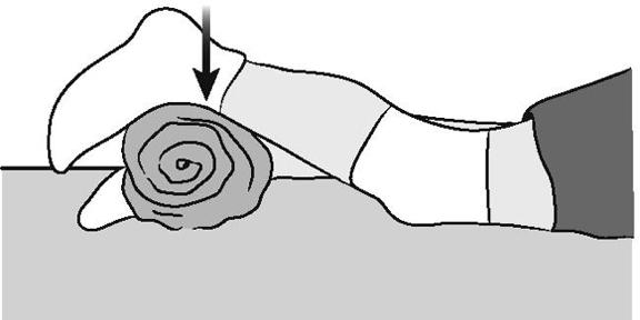 Lie on stomach with a towel roll under the ankle of your involved knee. Push ankle down into the towel roll. Your leg should straighten as much as possible. Hold for 5 seconds, then relax.