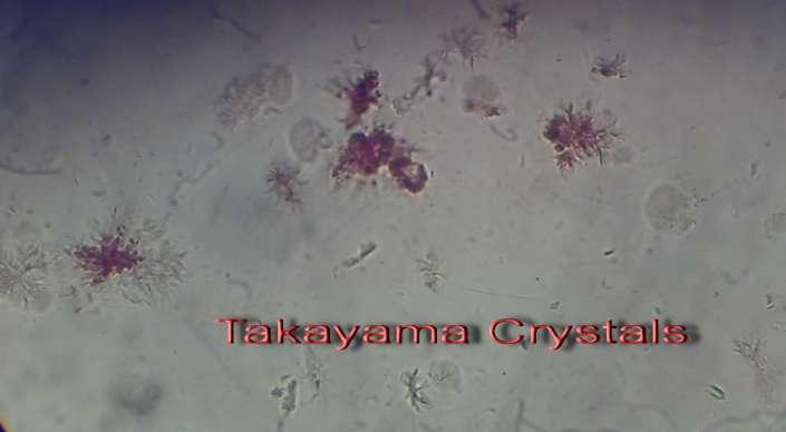 Takayama Test Microscopic test for