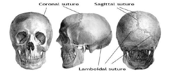 When you are born, skull is in several pieces that fuse