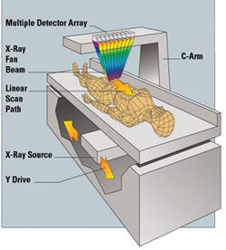 Dual energy X-ray absorptiometry (DEXA) 33 Primarily used to determine bone mineral density (BMD).