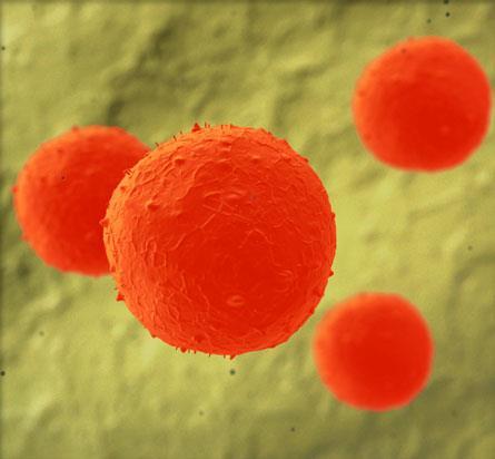 CAN STEM CELLS TREAT PARKINSONS DISEASE?