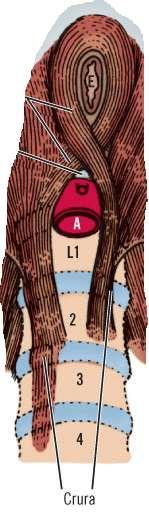 The Diaphragm: Lumbar part The Crura i. The right crus of the diaphragm originates from the bodies of vertebrae Ll- L4. ii.