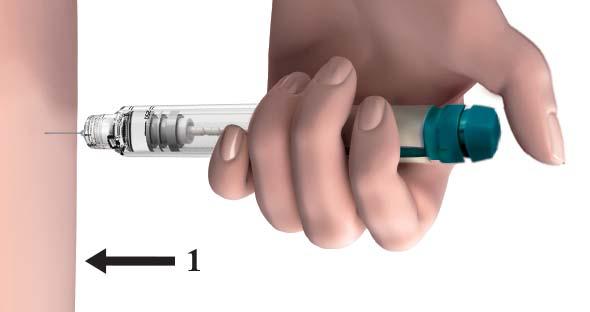 5. Injecting the dose 5.1. Choose the injection site in the area your doctor or nurse has told you to give the injection. 5.2. Clean the skin at the injection site by wiping with an alcohol swab. 5.3.