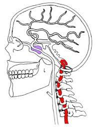 Considerations and Cautions for TOS" Vertebrobasilar insufficiency