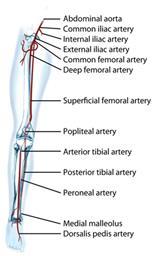 Peripheral Artery Disease (PAD) Many people will be involved in the diagnosis and treatment of Peripheral Artery Disease (PAD), but you are the most important.