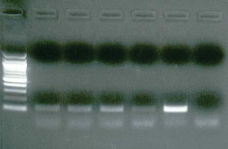 Gel-Based RT-PCR Assay