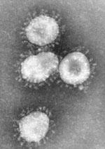 Coronaviruses Genus under Coronaviridae family Irregularly-shaped particles 60-220 nm in