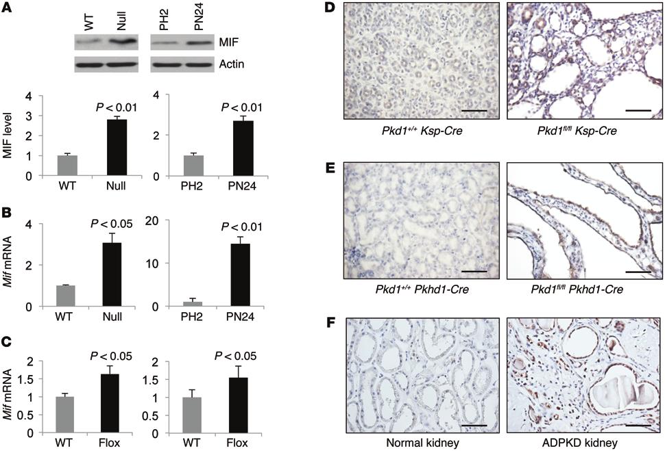 Research article The Journal of Clinical Investigation Figure 1. Pkd1 mutant renal epithelial cells and tissues demonstrated increased expression of MIF.