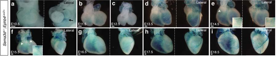 1 2 3 4 5 6 7 8 9 10 11 12 13 14 15 16 Supplementary Figure 1 (a-r) Whole mount X-gal staining on a developmental time-course of hearts from Sema3d +/- ;Ephb4 LacZ/+ and Sema3d -/- ;Ephb4 LacZ/+