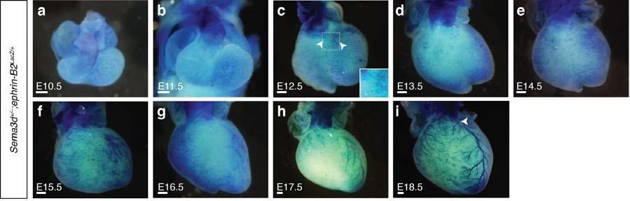 18 19 20 21 22 23 24 25 Supplementary Figure 2 (a-r) Whole mount X-gal staining on a developmental time-course of hearts from Sema3d +/-