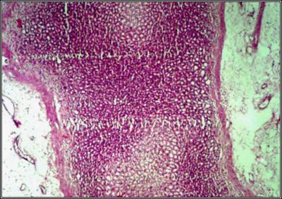 4 Fig 1 C: Histopathological view of normal rat gastric mucosa 3 of 6 Histamine acid phosphate produced linear ulcers in 100% animals of the control group.