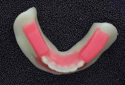 After this clinical try-in, the Wagner Try-in was scanned for creating a final design STL file for the definitive digital denture (Fig. 13).