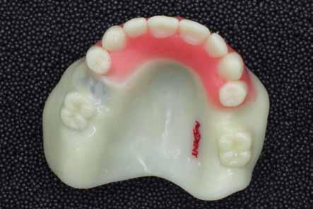 Teeth were arranged to the reference and a final base was built before the design file was sent to customer for Figure 10 Final QC photos of maxillary Wagner Try-in, note the milled maxillary