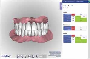 Figure 15 Maxillary and mandibular digital setup with reference is reviewed
