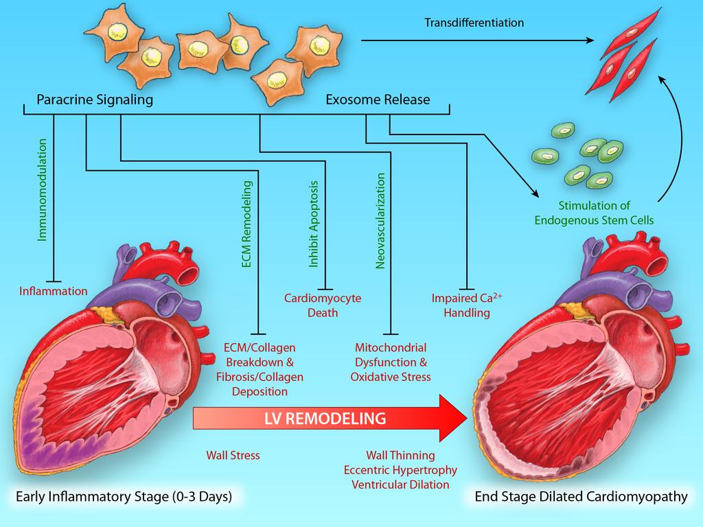 Banerjee et al Clinical Studies of Stem Cells for Cardiac Disease 269 Figure 2. Left ventricular (LV) remodeling and potential targets for stem cell therapy.