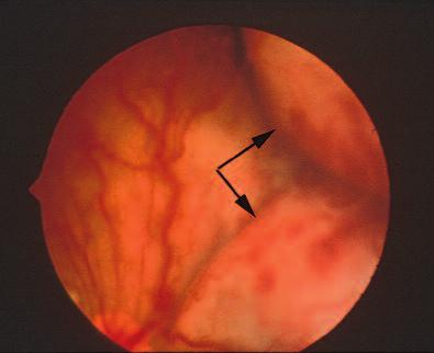 260 Small Animal/Exotics Compendium March 2001 Figure 3 Vitreous humor paracentesis. The needle enters the globe 7 to 9 mm from the limbus (a) and is directed toward the center of the eye (b).