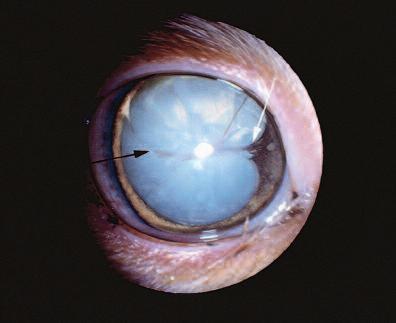 Compendium March 2001 Small Animal/Exotics 265 Figure 4 Cataract (black arrow), posterior synechia (white arrow), and iris pigmentation secondary to chronic anterior uveitis.