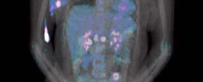 radiology procedures, including CT