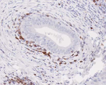 B cells were stained with pan B cell marker CD79α (red/brown) and with CD24