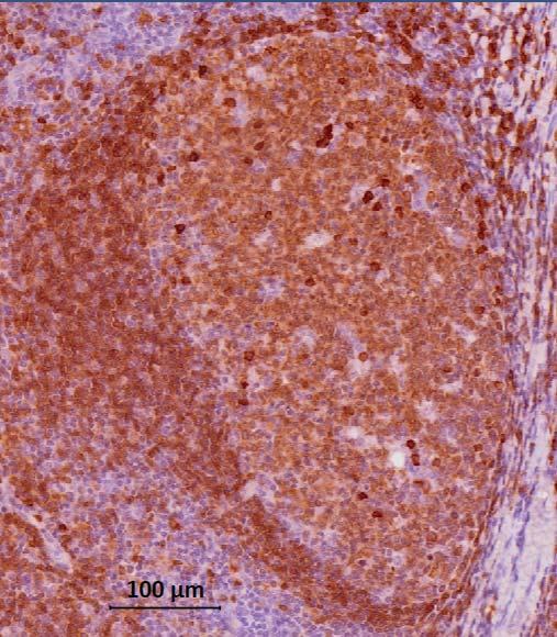 Figure 43 Diseased liver contains CD24- B cell