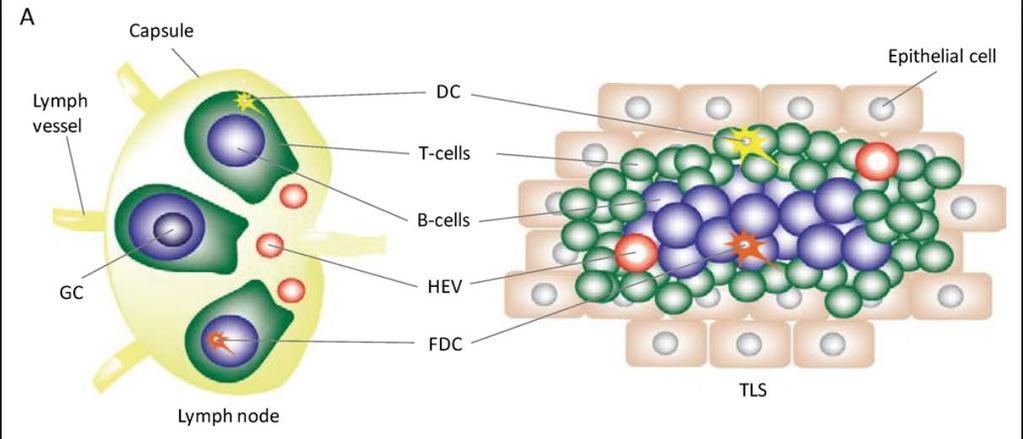 Figure 4 Comparing the secondary lymphoid follicle structure to the tertiary lymphoid structure (TLS).
