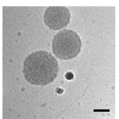 Scale bar: 100nm Extracellular vesicles: