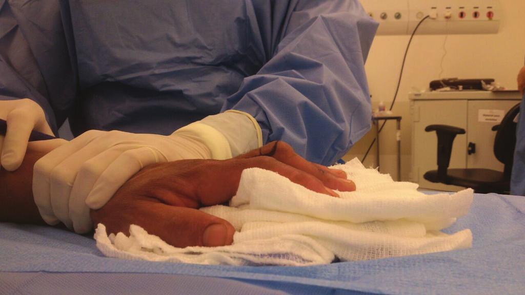 Khoo et al. 181 splinting prior to attempting surgical treatment. A variety of splints such as the Bunnel safety pin splint or dynamic spring based splits are available.