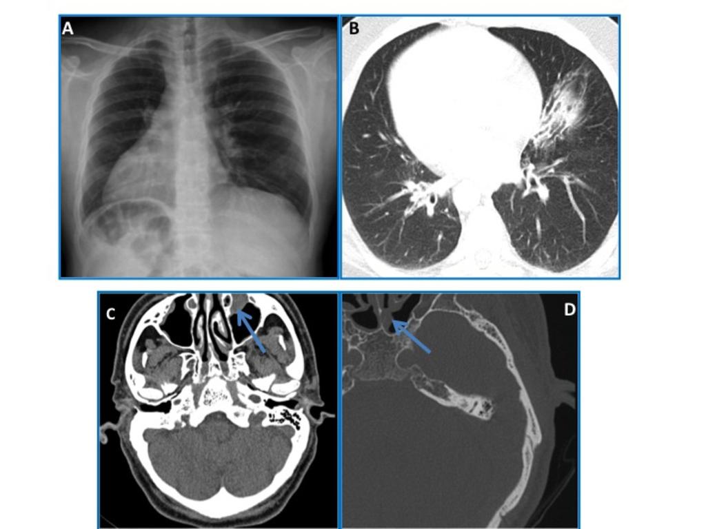 Fig. 7: Kartagener's syndrome in a 35-year-old male patient.
