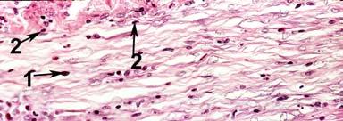 (polymorphonuclear leukocytes), outside of the mesothelial cell layer of the visceral pleura (Figure 4). NOVAKOV I., et al. Figure 5. Photomicrograph of normal rabbit visceral pleura(x 20).