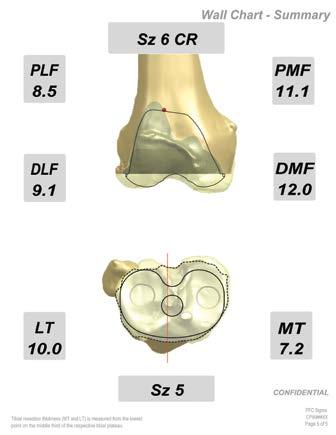 SURGICAL TIPS AND PEARLS PRE-OPERATIVE CONSIDERATIONS Order Submission Evaluate the M/L Joint Space Loss by utilizing weightbearing knee joint radiographs and provide the values with the order