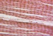 THERE ARE THREE TYPES OF MUSCLE TISSUE: SKELETAL MUSCLE ATTACHED TO BONES OF