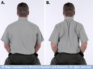 6. Shoulder Blade Squeeze Exercise A. Sit on an armless chair or stool. B. Keeping your chin tucked in and your chest high, pull your shoulder blades together.