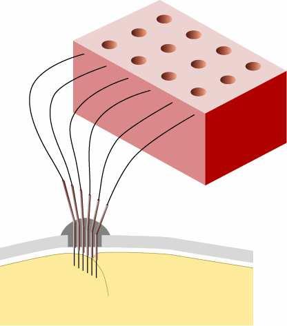 independently moveable microwire
