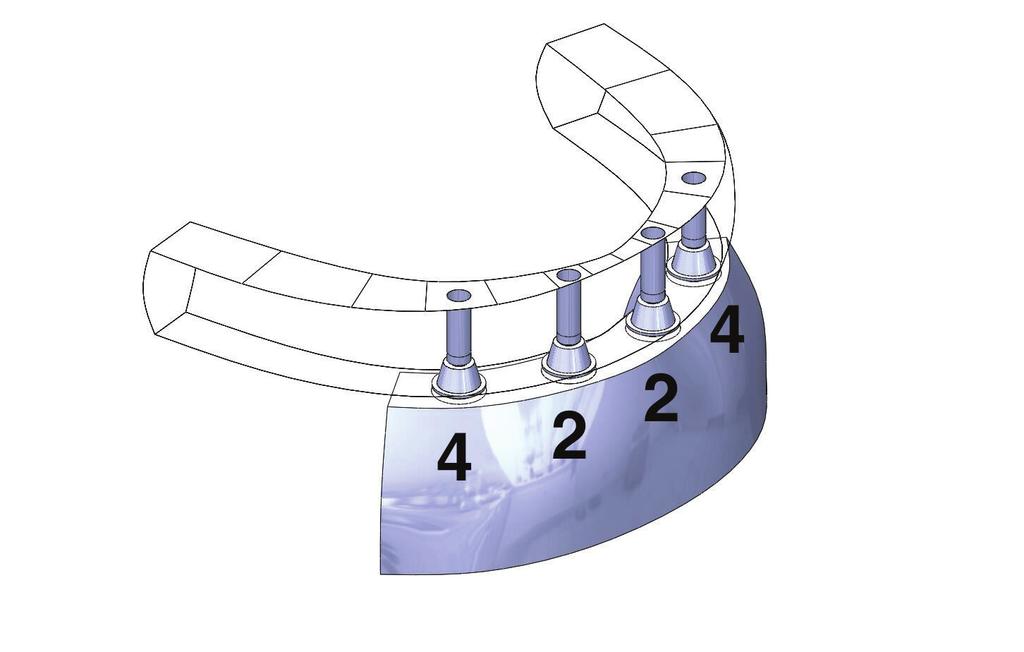 26 Fig. 2. Dental implants locations in the position of the central incisors [ 1 ] and the first premolars [ 4 