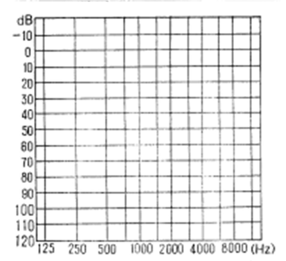 37 normal hearing impaired hearing db HL = actual threshold (db SPL) normal threshold (db SPL) From the China Rehabilitation Research Center for Deaf Children, Beijing.