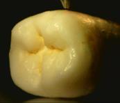 Adult top Adult concrement Baby top N 1s Teeth Comparable to the observed differences of elemental compositons in the survey