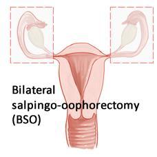 Risk Reduction Intervention Risk reduction surgery - Bilateral salpingo-oophorectomy -