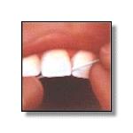 1.Hold a 18 ( 450mm) length of Floss between your fingers and wrap the ends of the floss around middle fingers until there s about 3 (60mm to 75mm) between them. 2.