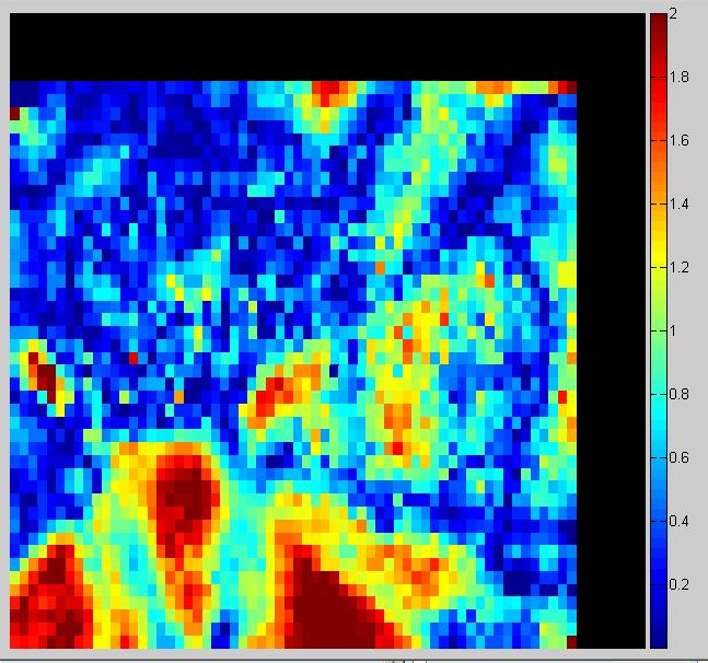 Figure D.68 Plan 4 measurement 2 full axial region, 7%/4mm gamma index analysis with 89.99% pixels passing (left) and 5%/3mm with 73.