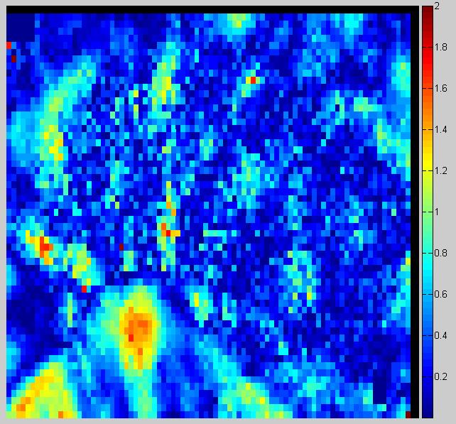 analysis with 98.82% pixels passing (left) and 5%/3mm with 93.