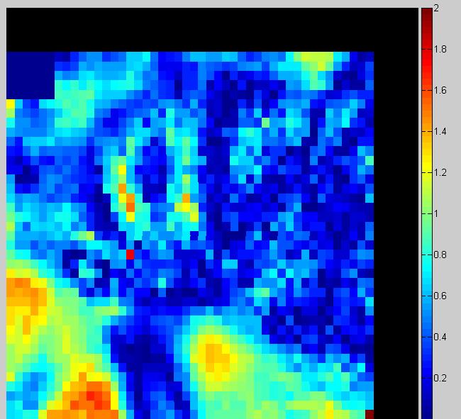 axial region, 7%/4mm gamma index analysis with 91.12% pixels passing (left) and 5%/3mm with 73.
