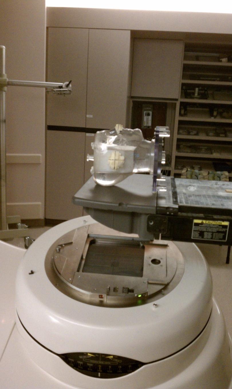 We delivered the baseline plan on the baseline machine, a Varian Clinac 2100 CD linac at MD Anderson Cancer Center in Houston, TX. This machine was equipped with the Varian Millennium 120 MLC.