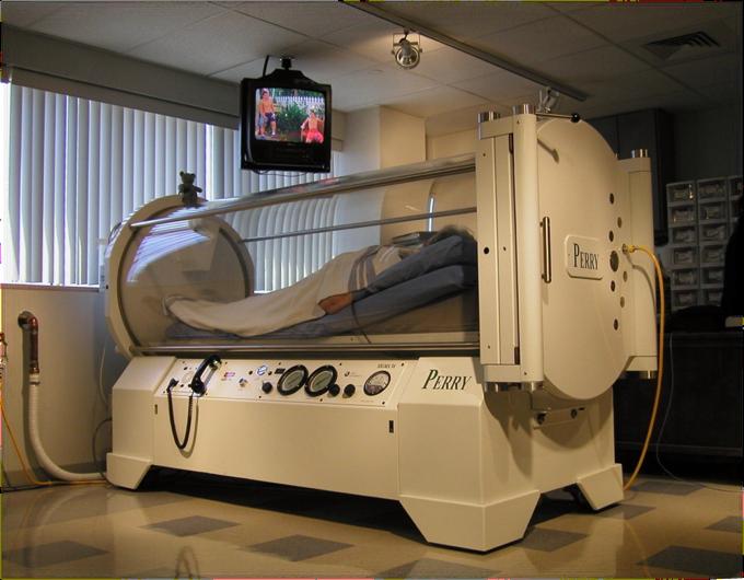 Hyperbaric Oxygen Therapy Adjunct to traditional wound healing 100% oxygen at 3 ATM of pressure Equivalent po2 2280mmHg Daily treatments