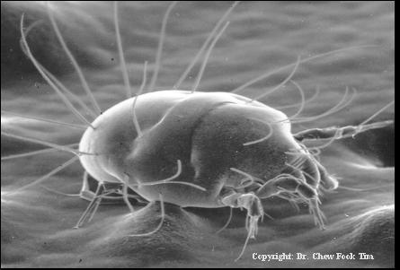 House dust mite (Copyright: Dr.