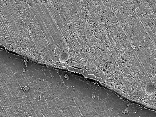 Using only acid etching (InA) showed a micro-gap of ~ 5 µm.