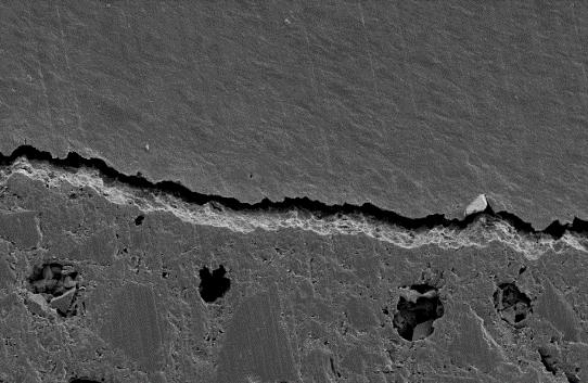 IA IAn 20 µm 20 µm InA InAn 20 µm 20 µm Figure 8-13 Interface (I) of experimental composite with 40 % calcium phosphate (Ct) to dentine (Dt)
