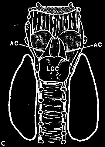 cartilage (LCC).