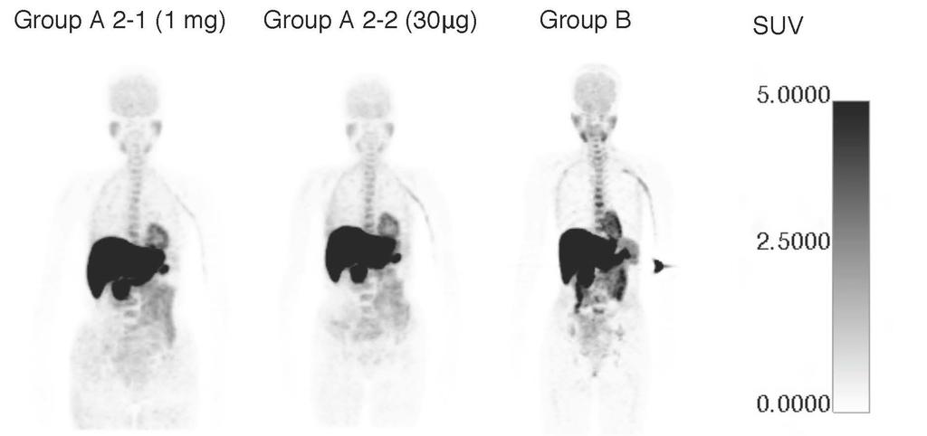 C-donepezil PET after Oral Dosing AOJNMB Mochida I et al concentration of DNP in each study.