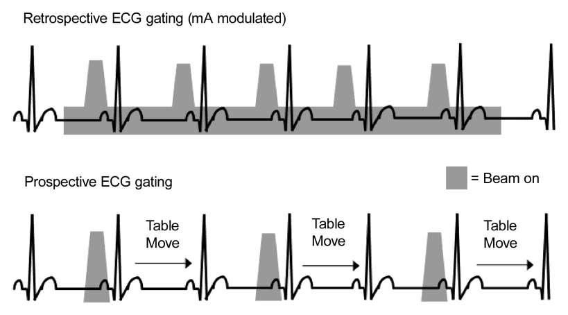 Coronary CT Model shows retrospective ECG gating versus prospective ECG gating.